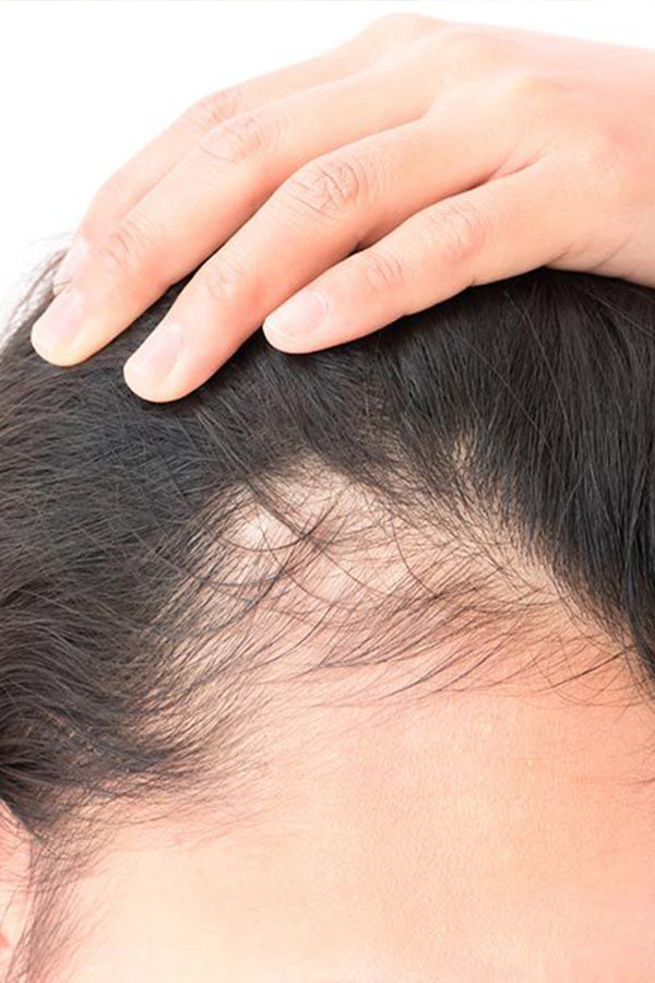 Combat Thinning Hair: How Asta’s Products Can Help